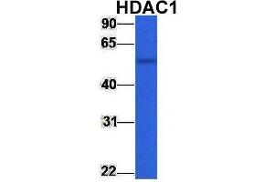 Host:  Rabbit  Target Name:  HDAC1  Sample Type:  Human Fetal Liver  Antibody Dilution:  1.
