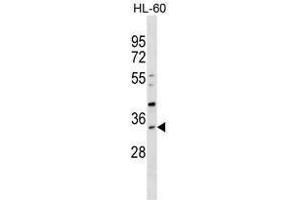 SULT1B1 Antibody (C-term) western blot analysis in HL-60 cell line lysates (35µg/lane). (SULT1B1 anticorps  (C-Term))