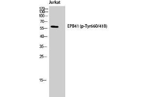 Western Blot (WB) analysis of Jurkat cells using Phospho-4.