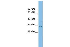 WB Suggested Anti-SNF8 Antibody Titration: 0. (SNF8 anticorps  (Middle Region))