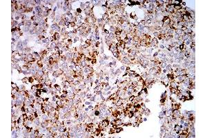 Immunohistochemistry (IHC) image for anti-Toll-Like Receptor 9 (TLR9) (AA 868-1016) antibody (ABIN5896728) (TLR9 anticorps  (AA 868-1016))