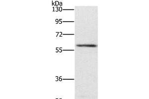 Western Blot analysis of Mouse spleen tissue using TRAFD1 Polyclonal Antibody at dilution of 1:400