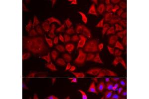Immunofluorescence analysis of HeLa cells using TARS Polyclonal Antibody (TARS anticorps)