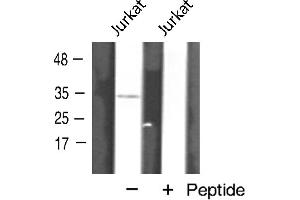 Western blot analysis of AQP12 expression in Jurkat cells (Aquaporin 12A anticorps  (C-Term))