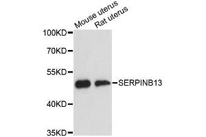 Western blot analysis of extracts of various cell lines, using SERPINB13 antibody (ABIN6292723) at 1:3000 dilution. (SERPINB13 anticorps)