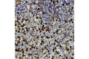 Immunohistochemistry of paraffin-embedded mouse spleen using CD11b/ITGAM antibody (ABIN3022179, ABIN3022180, ABIN3022181 and ABIN6218650) at dilution of 1:100 (40x lens). (CD11b anticorps  (AA 145-340))