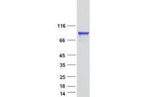 Validation with Western Blot