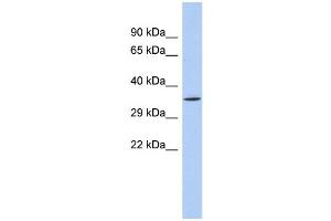 WB Suggested Anti-SIRT4 Antibody Titration:  0. (SIRT4 anticorps  (N-Term))
