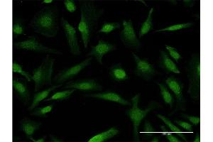 Immunofluorescence of monoclonal antibody to COMMD1 on HeLa cell.