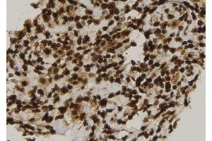 ABIN6279209 at 1/100 staining Human spleen tissue by IHC-P. (CIB4 anticorps  (C-Term))