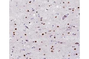 ABIN6266528 at 1/200 staining human brain tissue sections by IHC-P. (POLB anticorps  (C-Term))