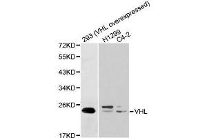 Western blot analysis of extracts of various cell lines, using VHL antibody. (VHL anticorps  (AA 1-172))
