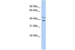 WB Suggested Anti-C11orf77 Antibody Titration: 0. (HARBI1 anticorps  (Middle Region))