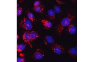 IF analysis of Glutathione Reductase using anti-Glutathione Reductase antibody (ABIN5693151). (Glutathione Reductase anticorps  (AA 256-522))