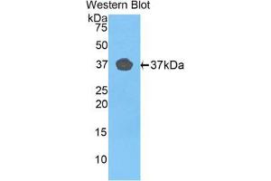 Western blot analysis of the recombinant protein. (FBLN4 anticorps  (AA 278-366))