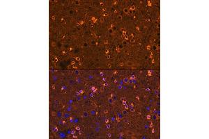 Immunofluorescence analysis of mouse brain using CRMP2/DPYSL2 Rabbit mAb  at dilution of 1:100 (40x lens).