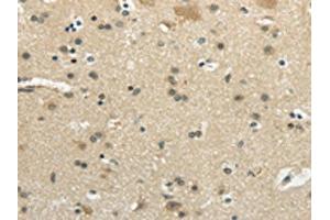 The image on the left is immunohistochemistry of paraffin-embedded Human brain tissue using ABIN7193051(WNK2 Antibody) at dilution 1/35, on the right is treated with synthetic peptide. (WNK2 anticorps)