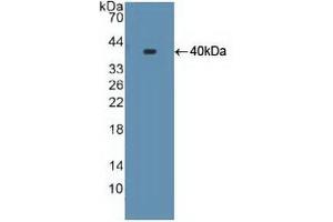 Figure. (CYP17A1 anticorps  (AA 183-508))