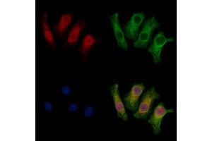ABIN7094018 and ABIN7098062 staining HepG2 cells by IF/ICC. (THAP2 anticorps  (Internal Region))