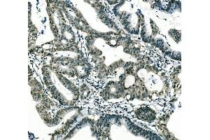 Figure 3 IHC analysis of MSI using anti-MSI antibody (ABIN7603130). (MSI1 anticorps  (N-Term))