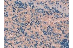 Detection of UCN in Rat Spleen Tissue using Polyclonal Antibody to Urocortin (UCN)