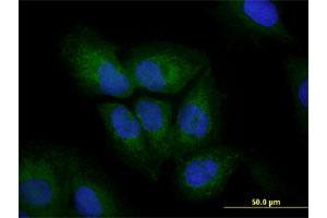 Immunofluorescence of monoclonal antibody to VIM on U-2 OS cell. (Vimentin anticorps  (AA 41-140))