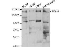 Western blot analysis of extracts of various cell lines, using MSH6 antibody. (MSH6 anticorps  (AA 1-290))