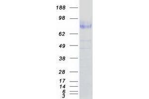 Validation with Western Blot