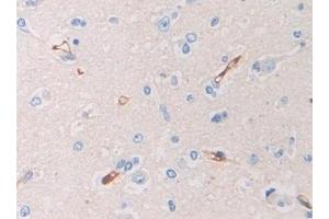 Detection of PZP in Human Cerebrum Tissue using Polyclonal Antibody to Pregnancy Zone Protein (PZP)