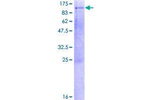 Image no. 1 for Kinesin Family Member 3B (KIF3B) (AA 1-747) protein (GST tag) (ABIN1308676)