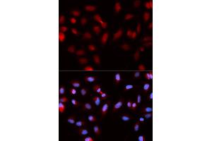 Immunofluorescence (IF) image for anti-Baculoviral IAP Repeat-Containing 5 (BIRC5) antibody (ABIN1875407)