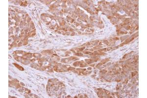 IHC-P Image 14-3-3 theta antibody detects YWHAQ protein at cytosol on H358 xenograft by immunohistochemical analysis.