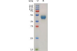 Chemokine (C-X-C Motif) Receptor 7 (CXCR7) (AA 1-40) protein (Fc Tag)