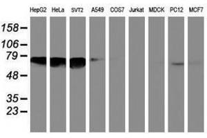 Image no. 1 for anti-N-Myristoyltransferase 2 (NMT2) antibody (ABIN1499784) (NMT2 anticorps)