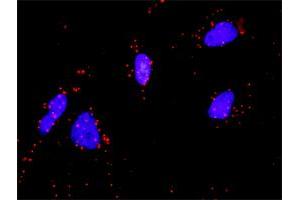 Proximity Ligation Analysis of protein-protein interactions between FGF1 and FGFR4.