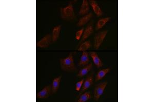 Immunofluorescence analysis of NIH/3T3 cells using SIRT3 Rabbit pAb (ABIN6134063, ABIN6147792, ABIN6147795 and ABIN6223143) at dilution of 1:50 (40x lens).