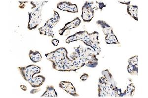 IHC analysis of GOLPH2/GOLM1 using anti-GOLPH2/GOLM1 antibody (ABIN7601505).