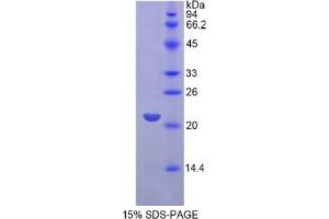 SDS-PAGE of Protein Standard from the Kit (Highly purified E.