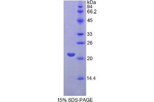 SDS-PAGE of Protein Standard from the Kit (Highly purified E. (FGF13 Kit ELISA)