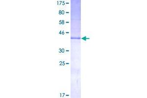 KiSS-1 Metastasis-Suppressor (KISS1) (AA 1-138) protein (GST tag)