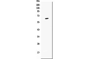 Western blot analysis of CD137 using anti-CD137 antibody (ABIN6719263).