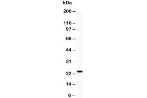 Western blot testing of Claudin-5 antibody and rat liver (Claudin 5 anticorps  (AA 191-218))