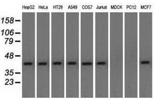 Image no. 3 for anti-Nucleoredoxin-Like 2 (NXNL2) antibody (ABIN1499887) (NXNL2 anticorps)