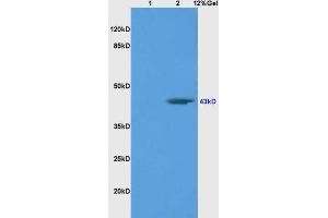 Lane 1: rat brain lysates Lane 2: human colon carcinoma lysates probed with Anti BRN3A Polyclonal Antibody, Unconjugated (ABIN702400) at 1:200 in 4 °C.
