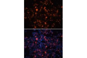 Immunofluorescence analysis of 293T cells using Mouse anti His-Tag mAb. (His Tag anticorps)