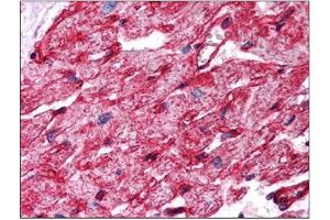 Image no. 1 for anti-Caveolin 1, Caveolae Protein, 22kDa (CAV1) (Internal Region) antibody (ABIN374578) (Caveolin-1 anticorps  (Internal Region))