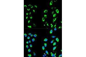Immunofluorescence analysis of HeLa cells using NFKBIA antibody (ABIN4904527). (NFKBIA anticorps)