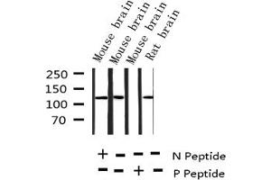 Western blot analysis of Phospho-Amyloid beta A4 (Thr743/668) expression in various lysates (APP anticorps  (pThr668))