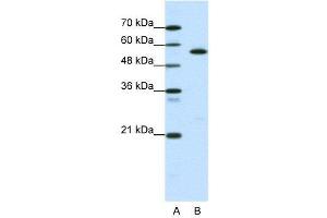WB Suggested Anti-CORO1A  Antibody Titration: 0. (Coronin 1a anticorps  (Middle Region))