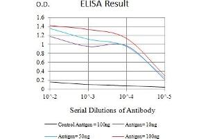 Black line: Control Antigen (100 ng),Purple line: Antigen (10 ng), Blue line: Antigen (50 ng), Red line:Antigen (100 ng)